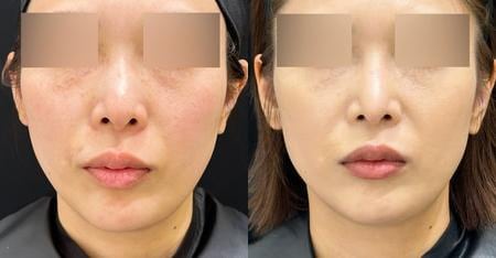 ベスト症例写真