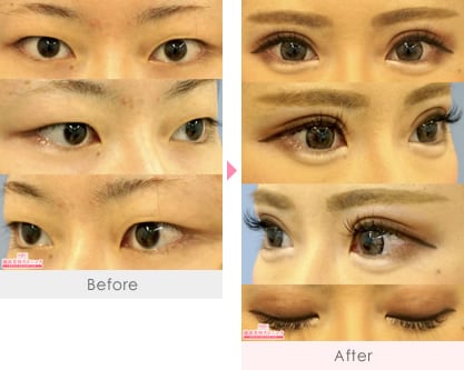 赤尾健医師 美容整形 美容外科 美容皮膚科なら湘南美容クリニック 公式