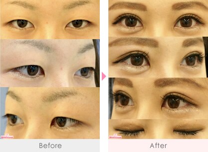 赤尾健医師 美容整形 美容外科 美容皮膚科なら湘南美容クリニック 公式