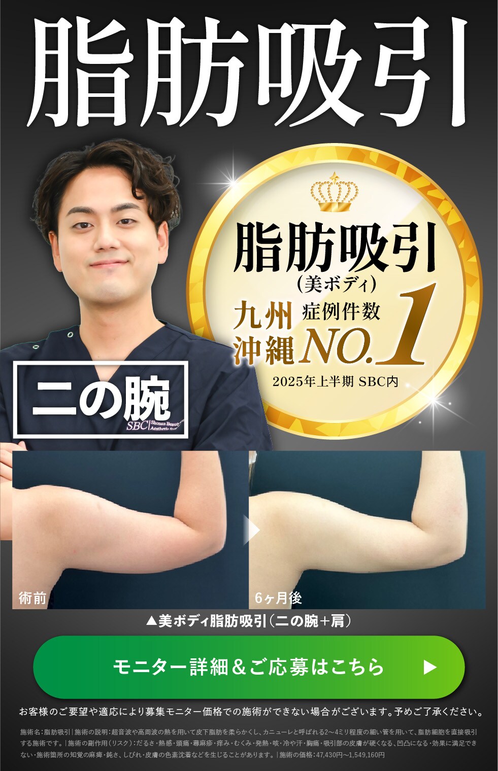 脂肪吸引 二の腕