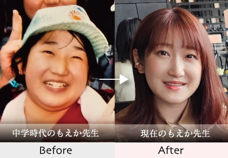ビフォーアフター
