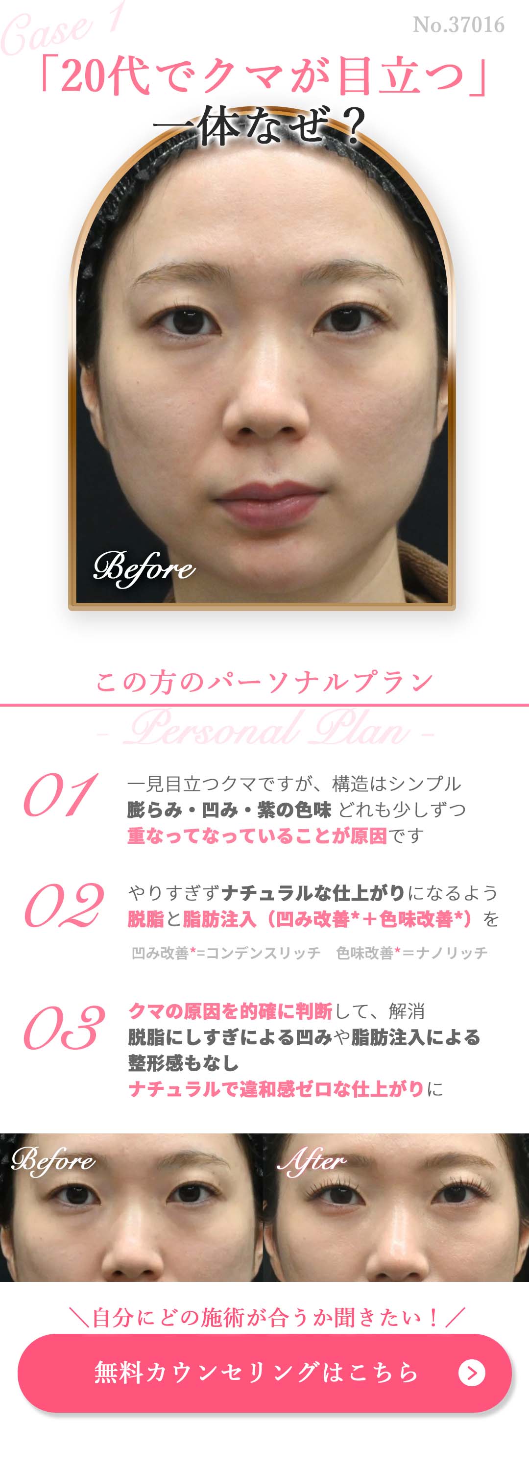 無料カウンセリングはコチラ