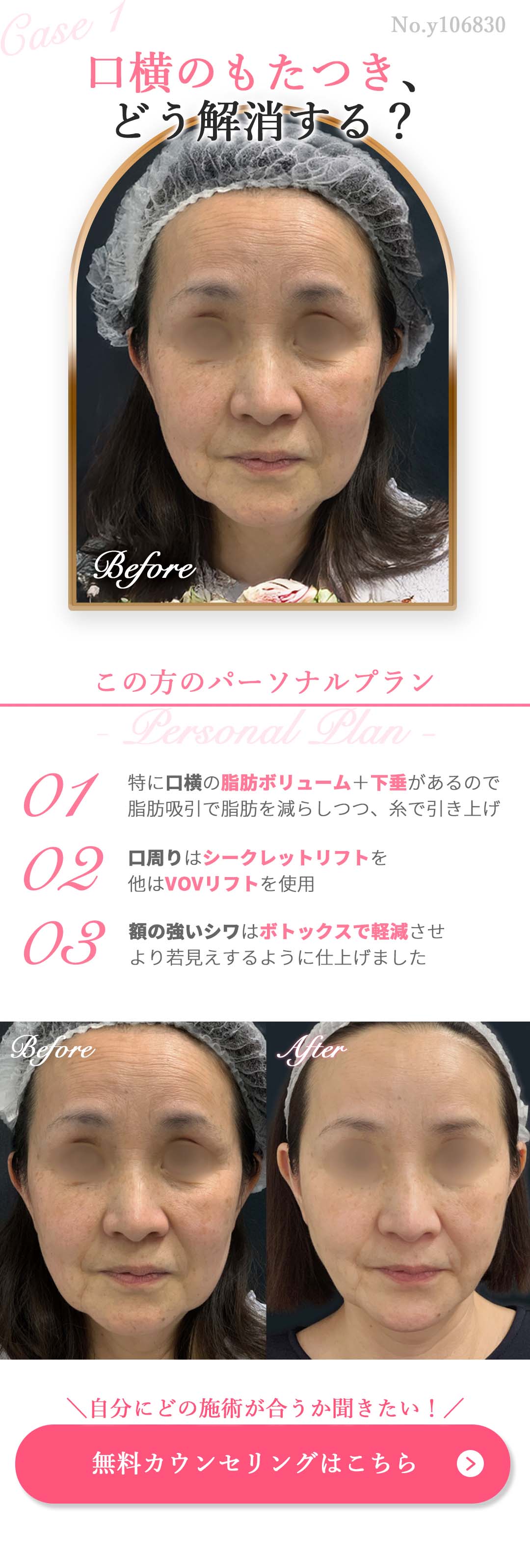 無料カウンセリングはコチラ