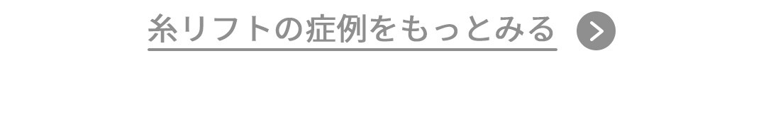 糸リフト症例