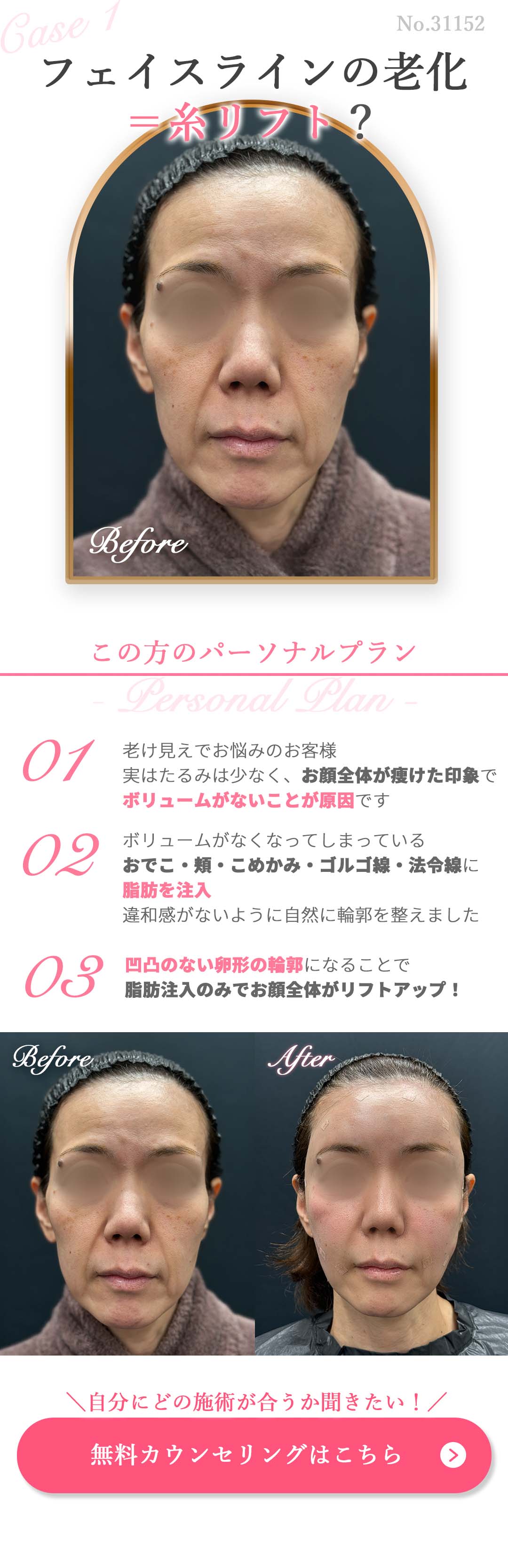 無料カウンセリングはコチラ