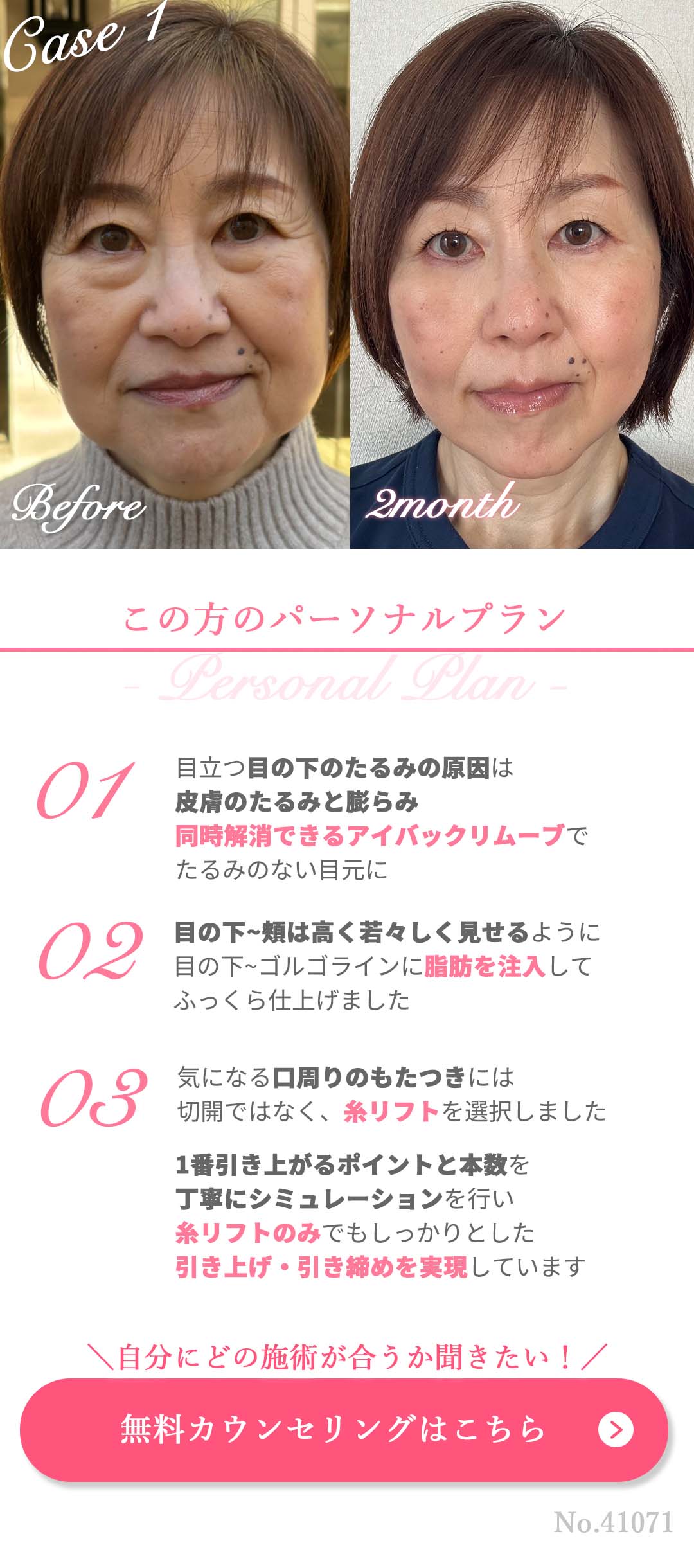 無料カウンセリングはコチラ