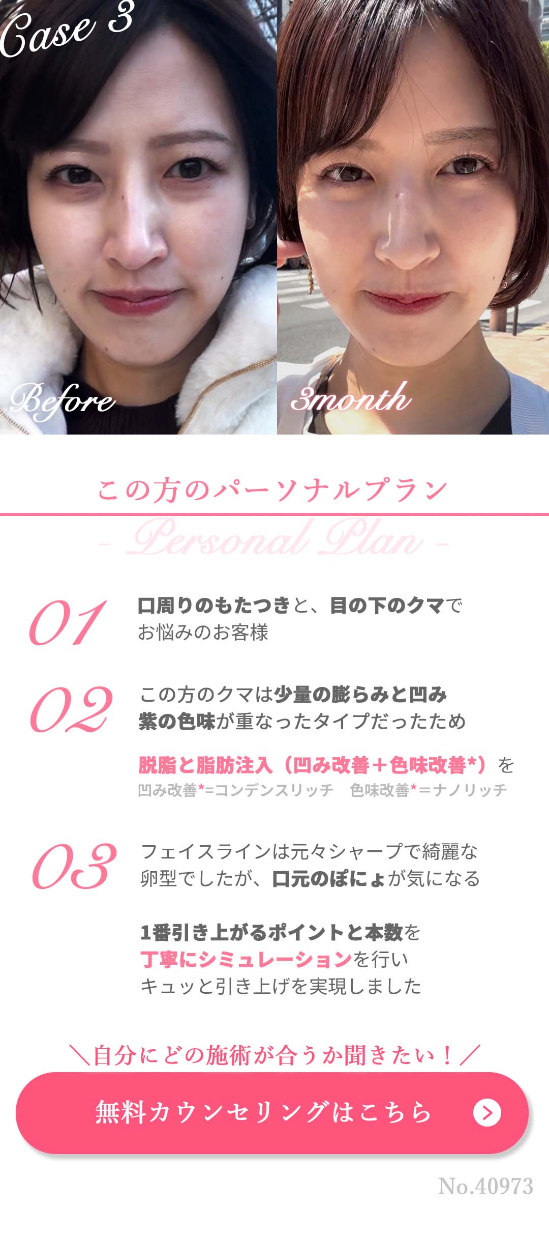 無料カウンセリングはコチラ