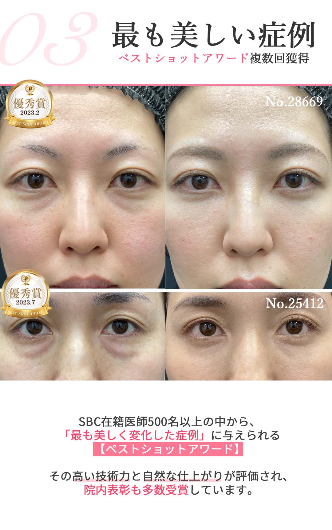 選ばれる理由03