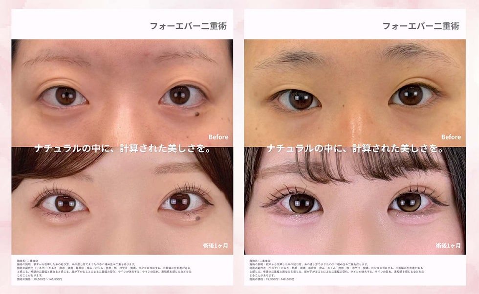 症例写真