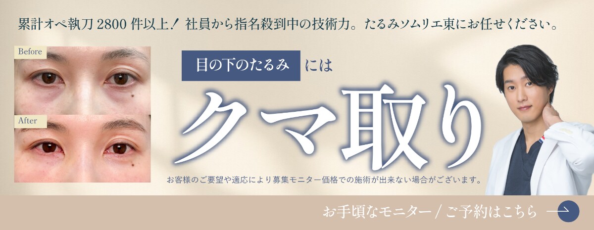 クマとり