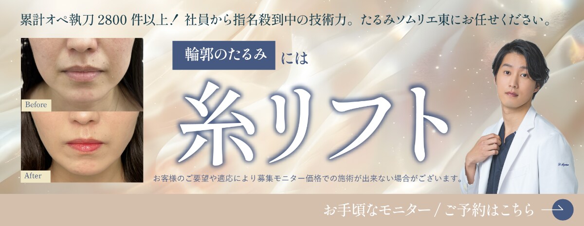 糸リフト