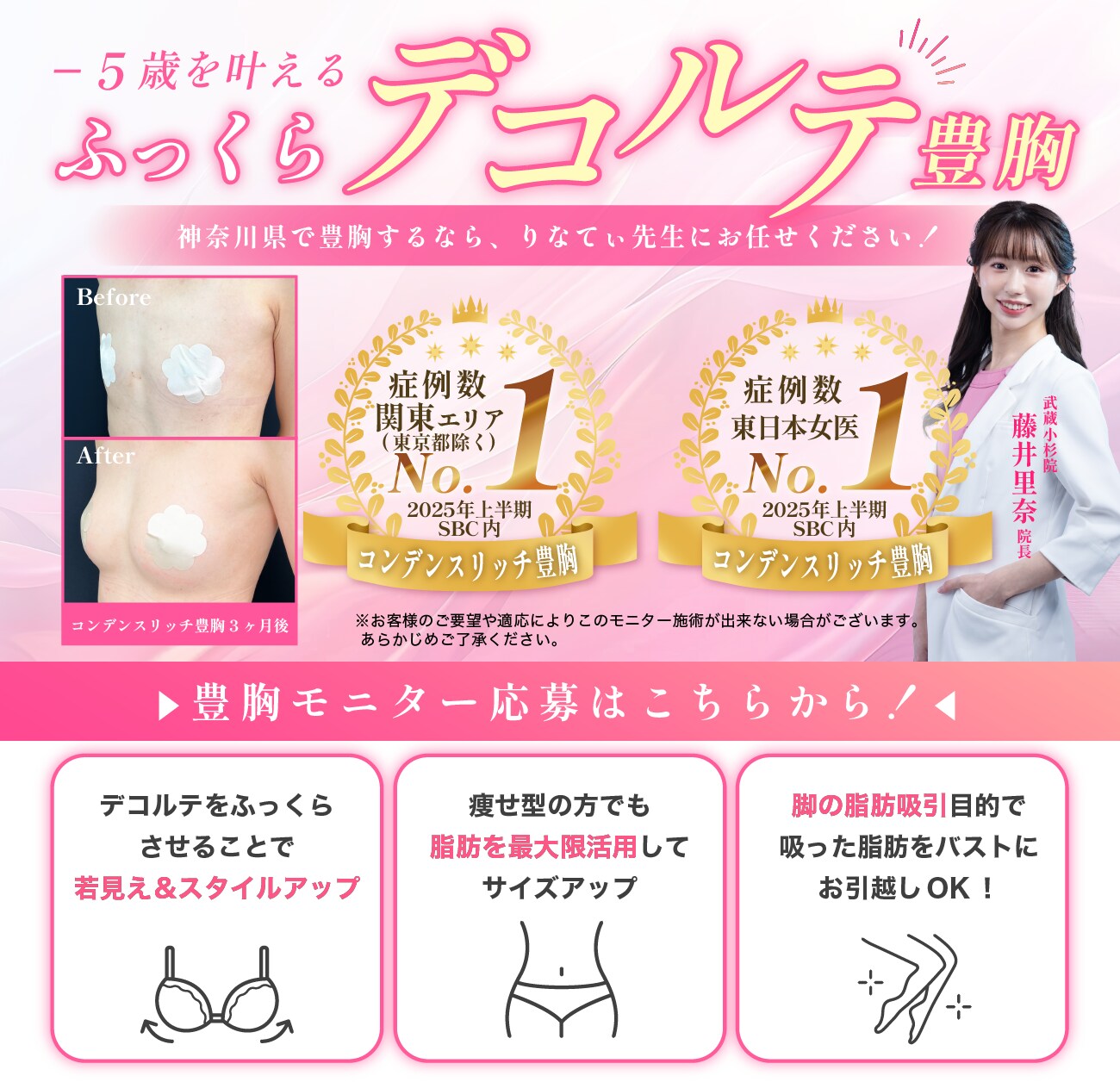 デコルテ豊胸