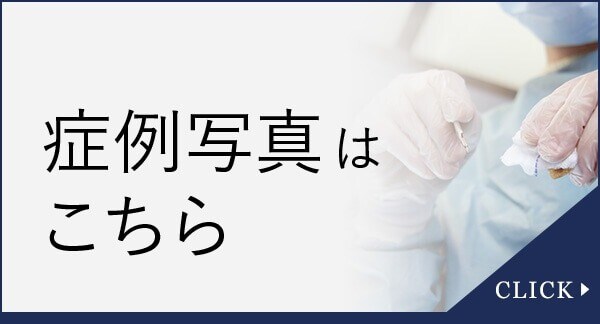 症例写真