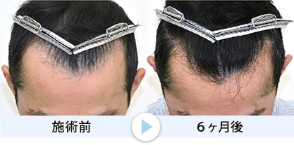 症例写真1