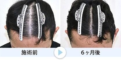 症例写真2