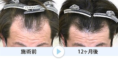 症例写真3