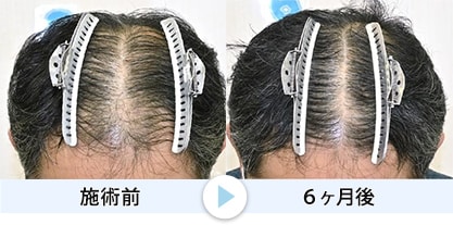 症例写真4