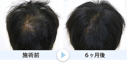 症例写真5