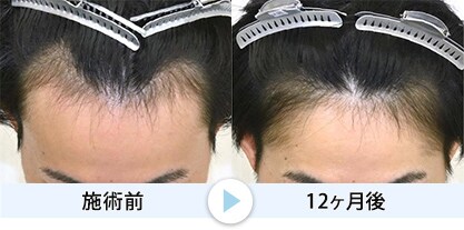 症例写真6