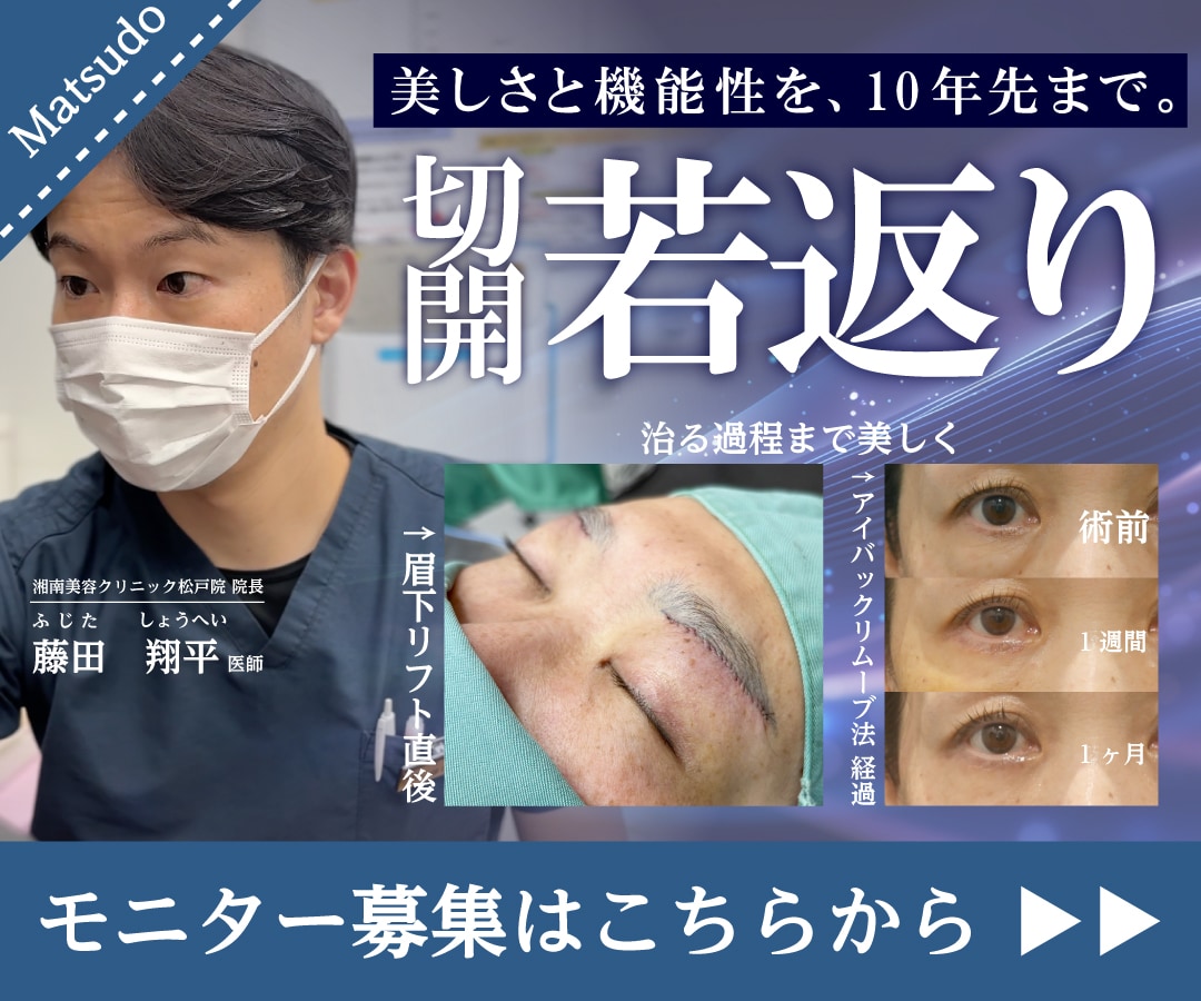 切開若返り