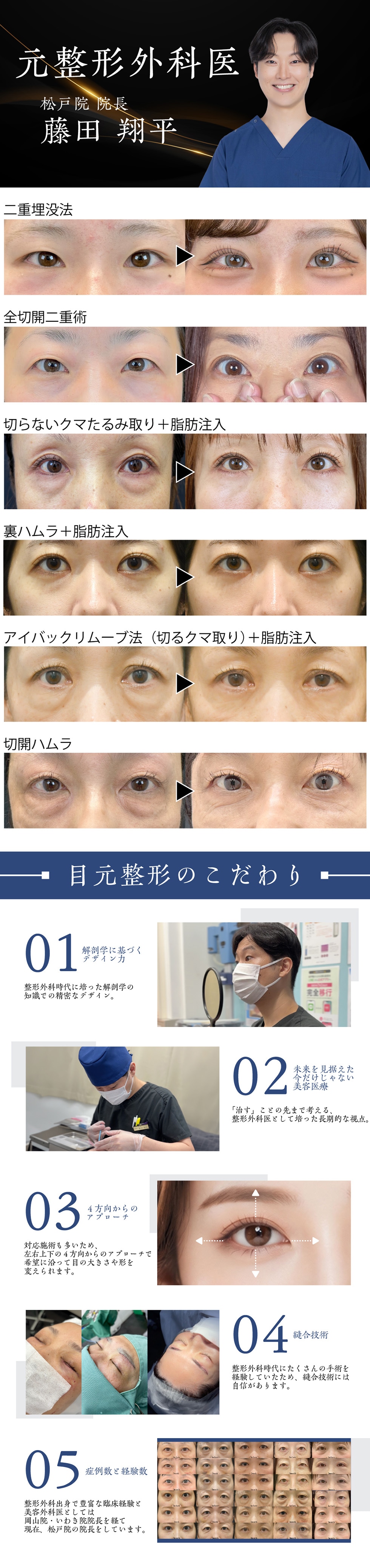 目元