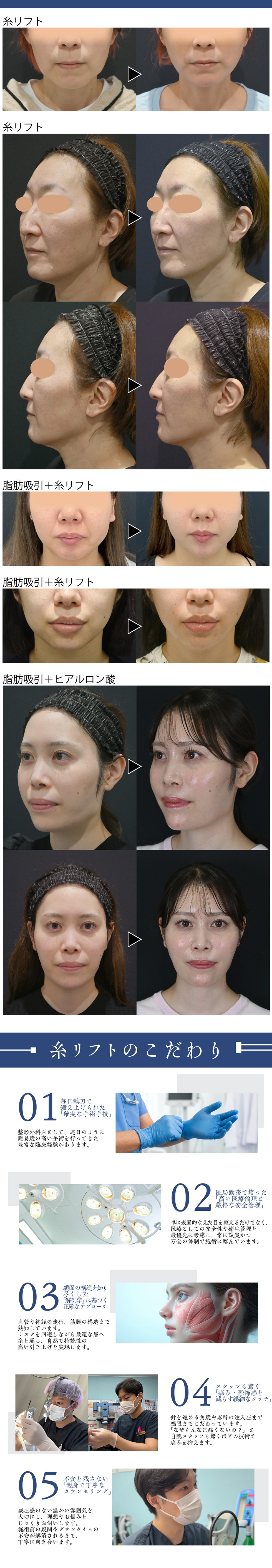 輪郭