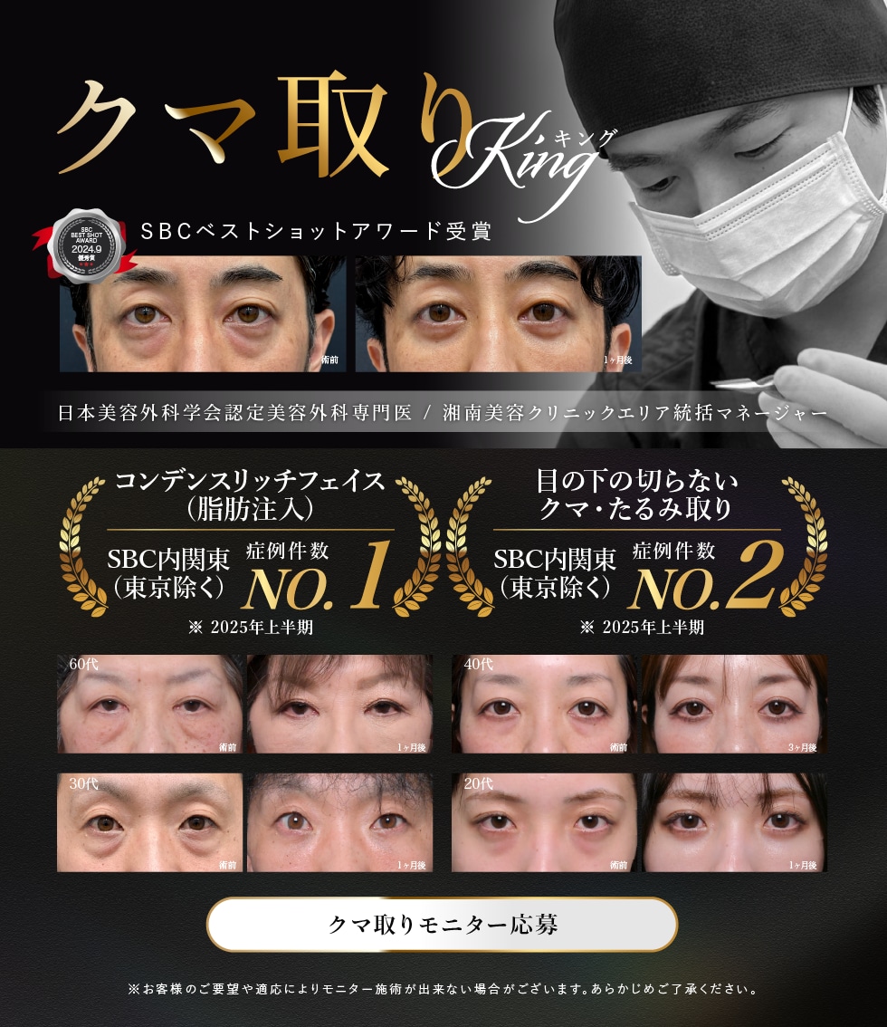 クマとりモニター