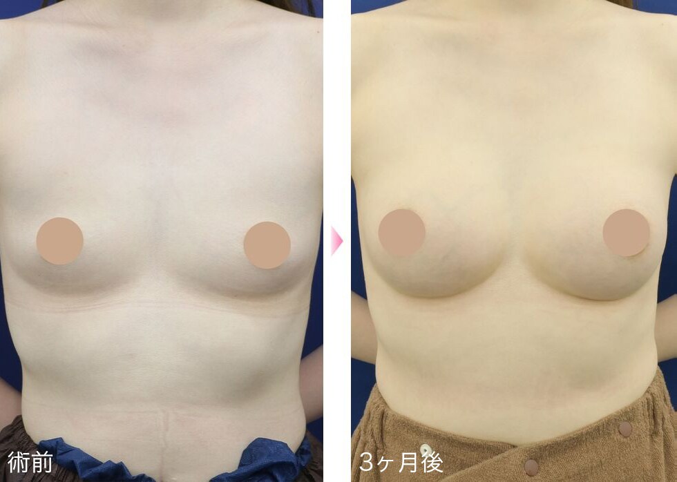 症例写真2