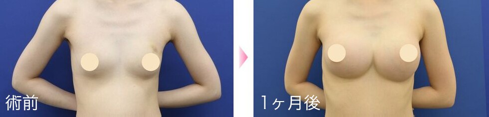 症例写真3