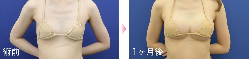 症例写真4