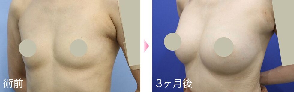 症例写真5