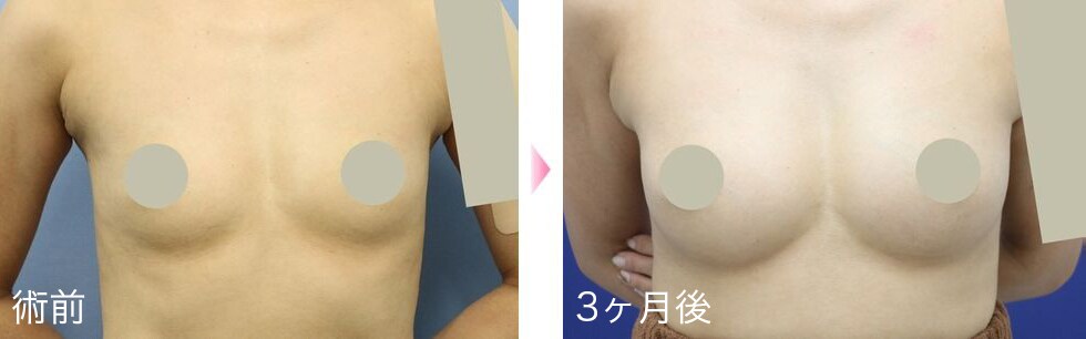 症例写真6