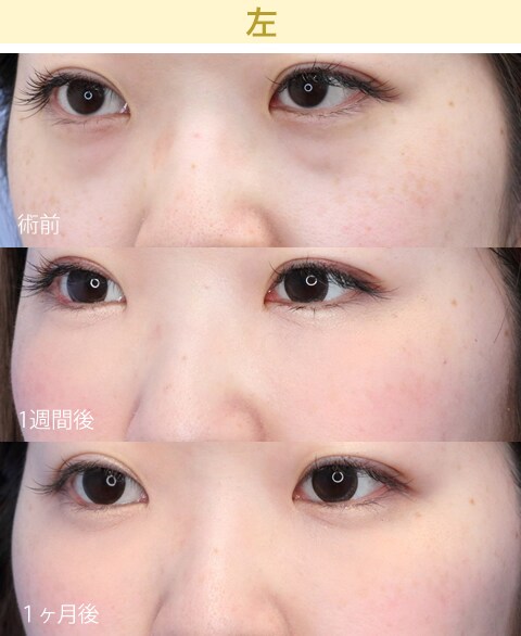 深田医師による極上の目元治療特集 美容整形 美容外科 美容皮膚科なら湘南美容クリニック 公式