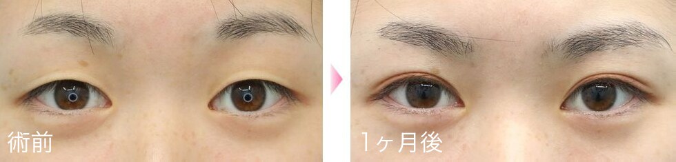 症例写真8