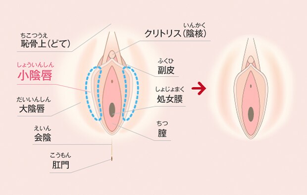 イマドキ女子のデリケートゾーン事情 美容整形 美容外科 美容皮膚科なら湘南美容クリニック 公式