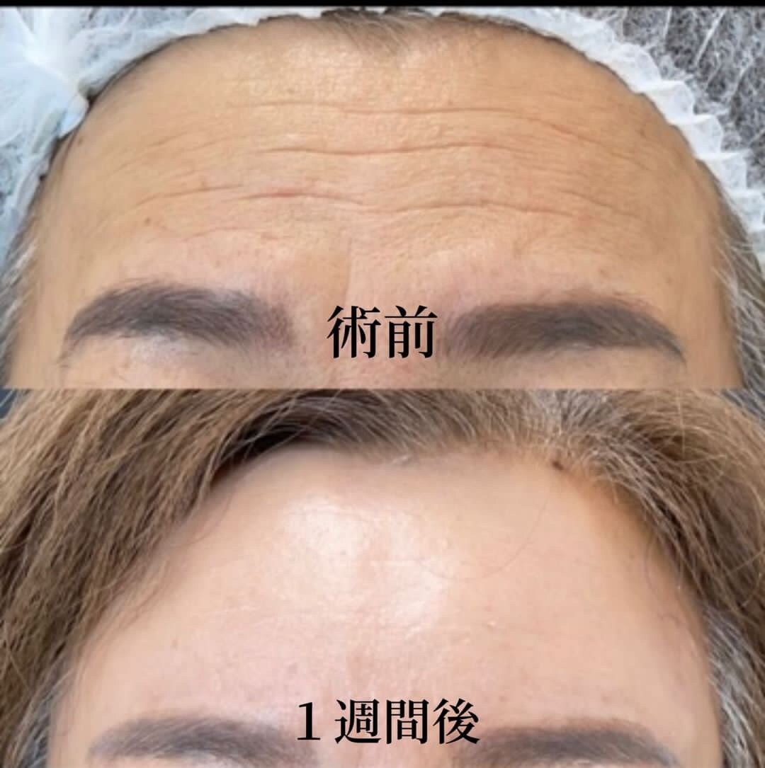 症例写真02