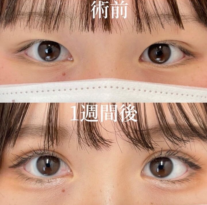 症例写真02