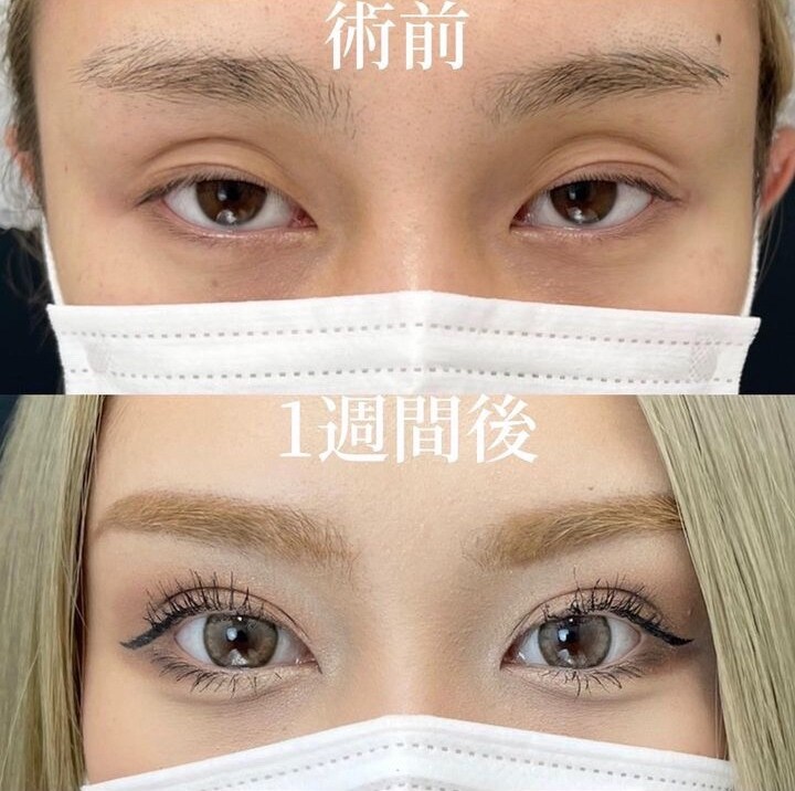症例写真02
