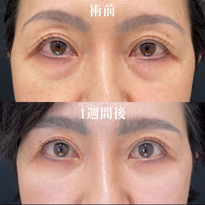 症例写真02