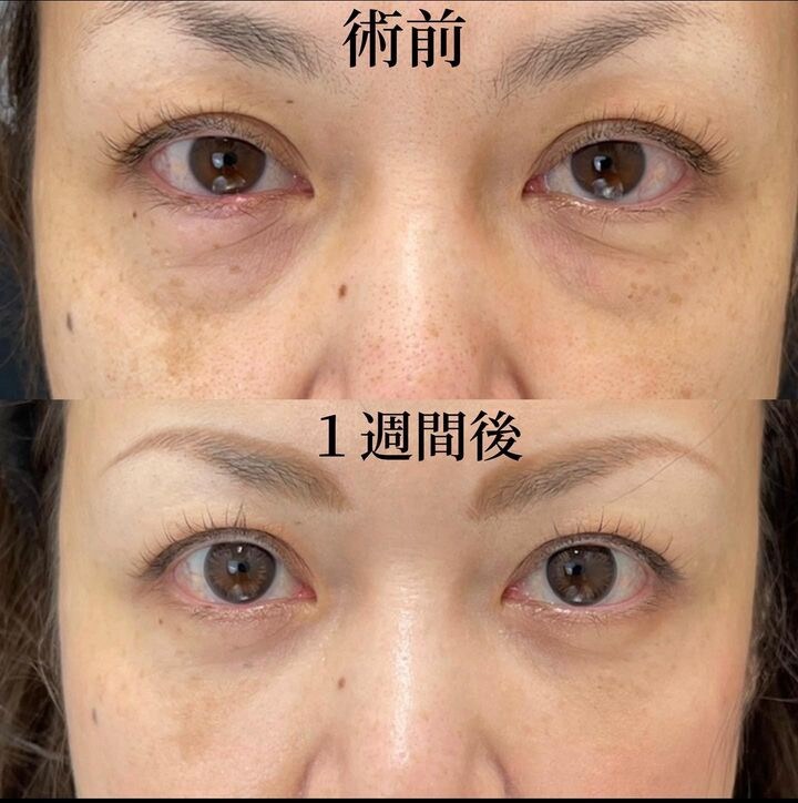 症例写真01