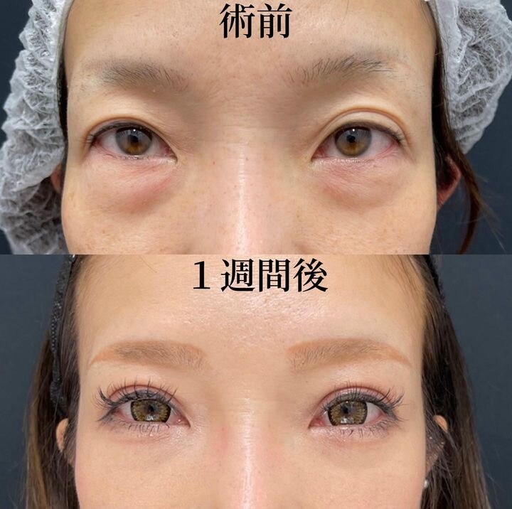 症例写真02