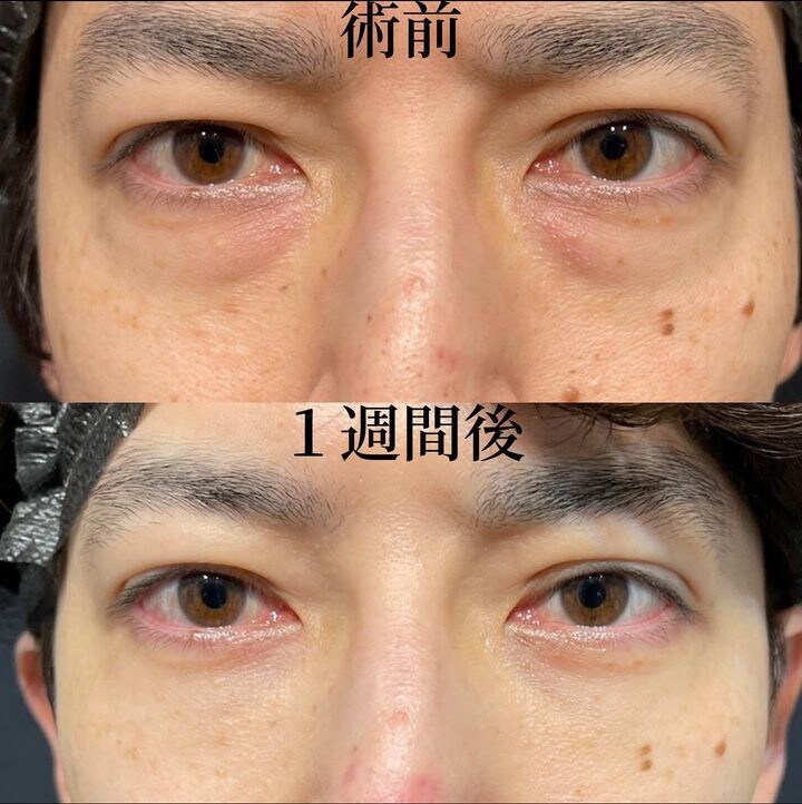 症例写真02