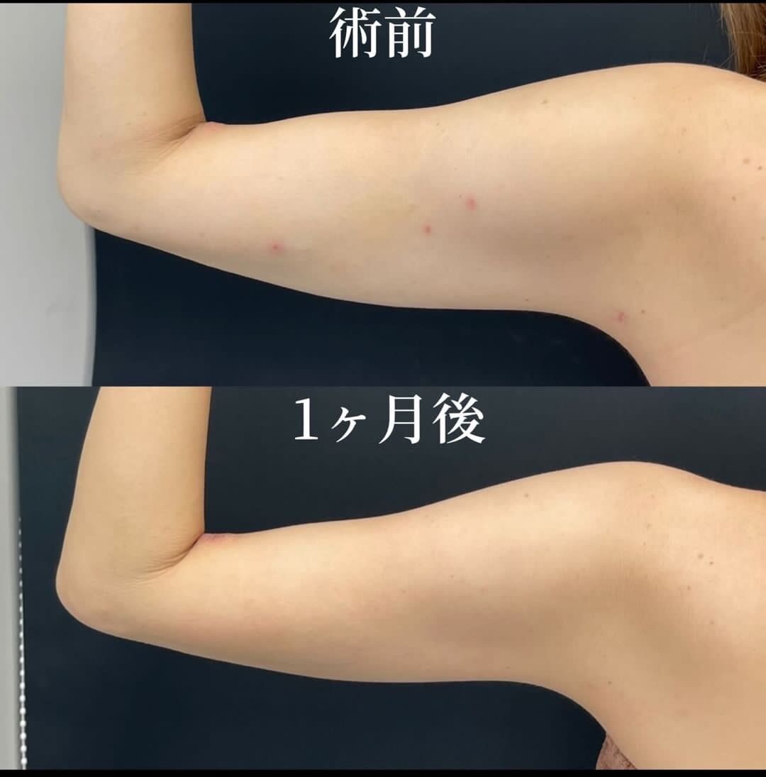 症例写真02