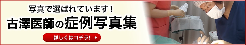 写真で選ばれています！古澤医師の症例写真集