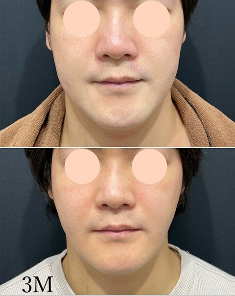 症例写真07