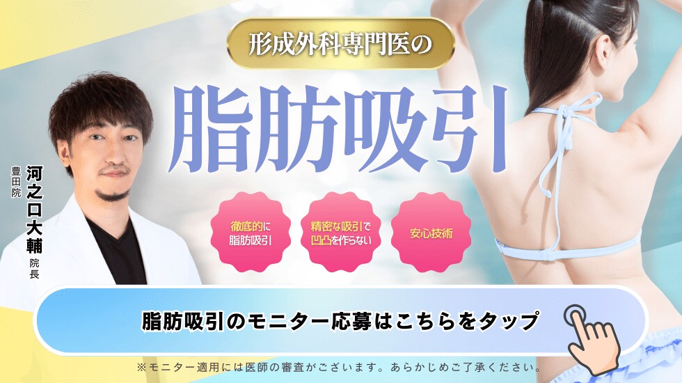 脂肪吸引