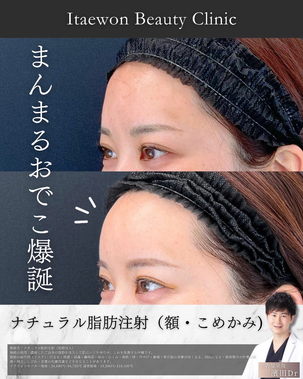 症例