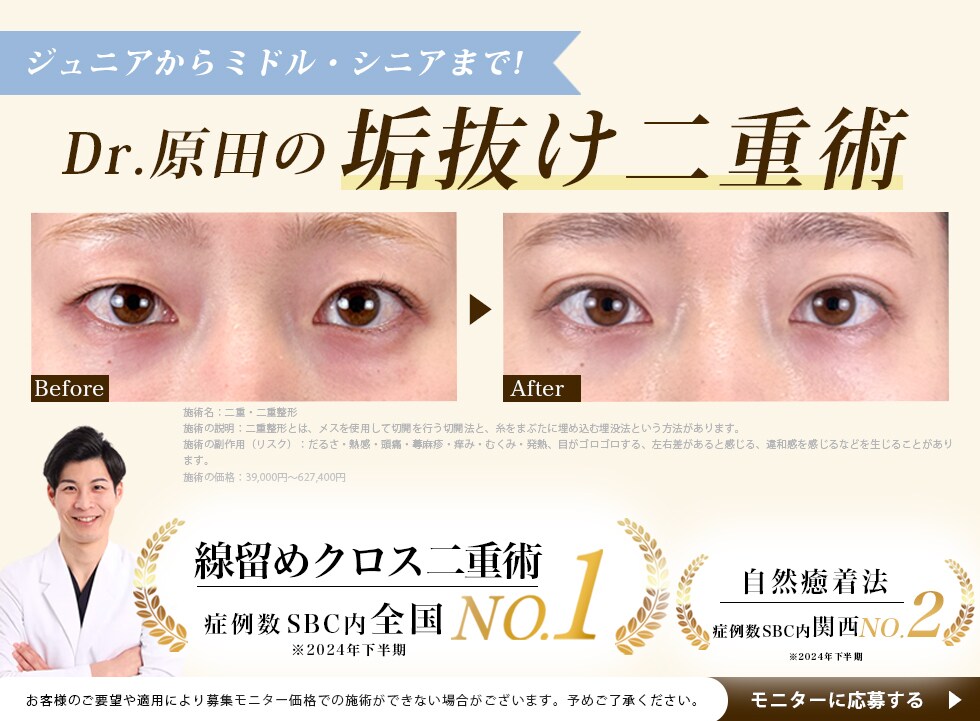 垢抜け二重術