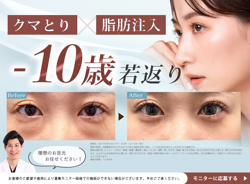 クマ取り×脂肪注入