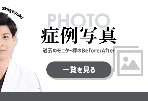 モニター募集